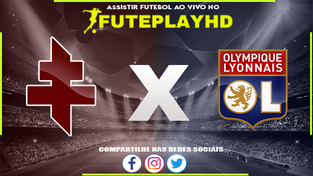 Assistir Metz x Lyon AO VIVO Online 23/02/2024